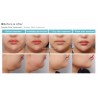 glamour silholine slim solution lipolytic fat dissolving